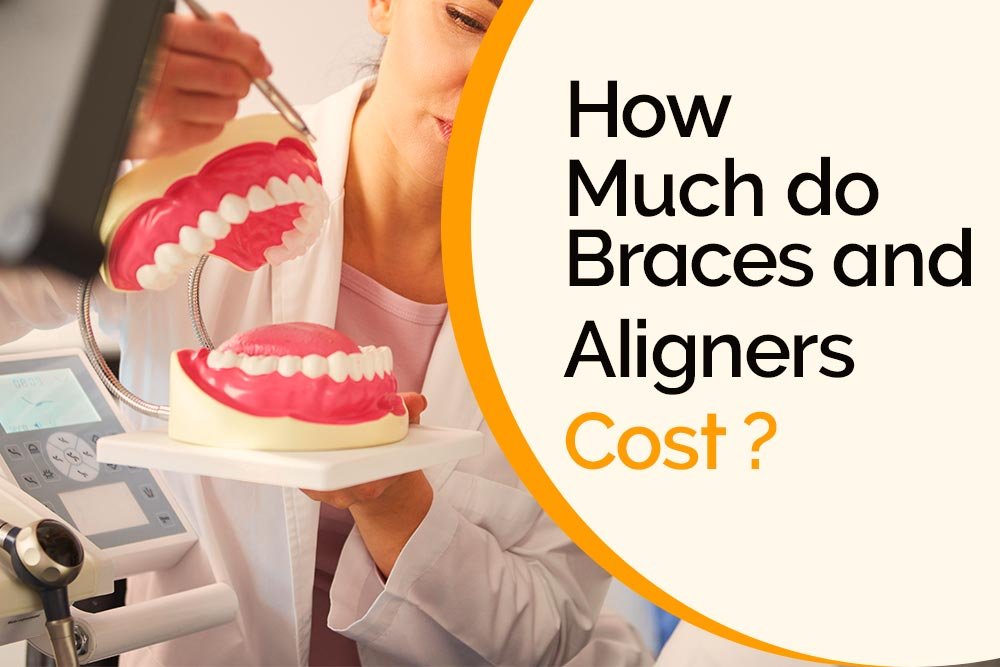 Read more about the article How Much Do Braces and Aligners Cost? A Financial Guide to the Cost of Orthodontic Treatment