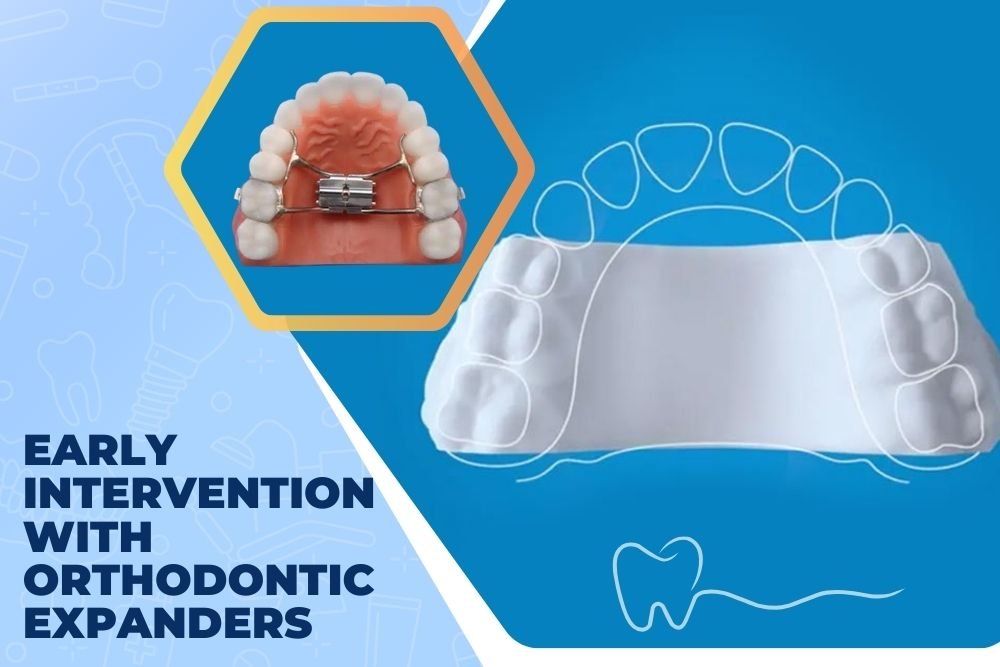 Orthodontic Expanders