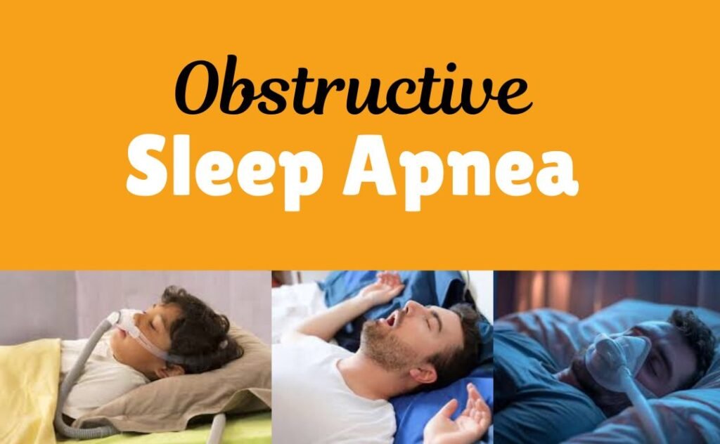 Obstructive Sleep Apnea