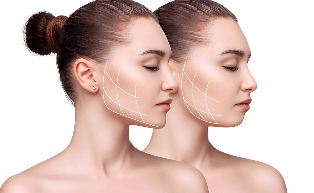 Jaw Surgery
