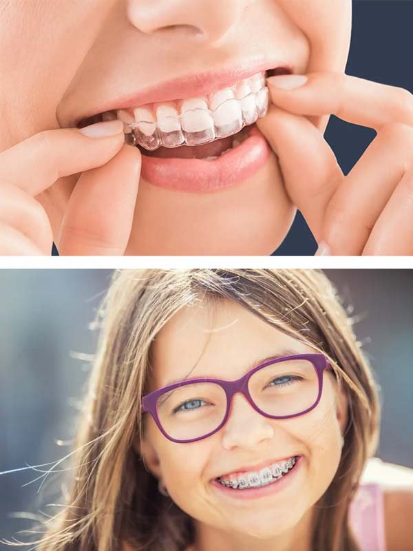 Smiling patient with clear aligners and braces at Art of Smile Orthodontics in Philadelphia