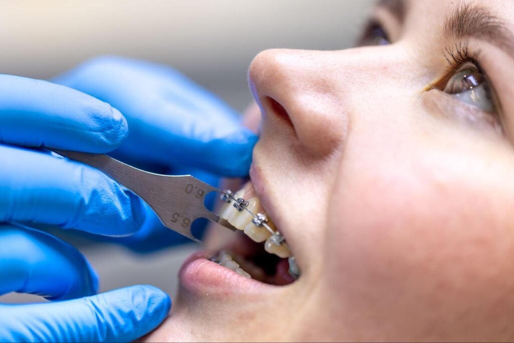 Orthodontic Treatment